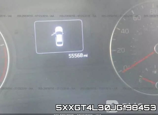 5XXGT4L30JG198453 фото 8