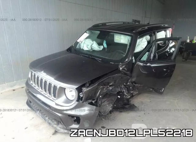 ZACNJBD12LPL52218 фото 3