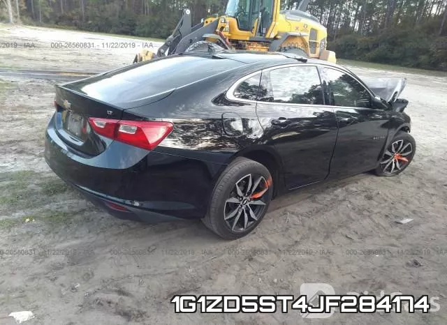 1G1ZD5ST4JF284174 фото 4