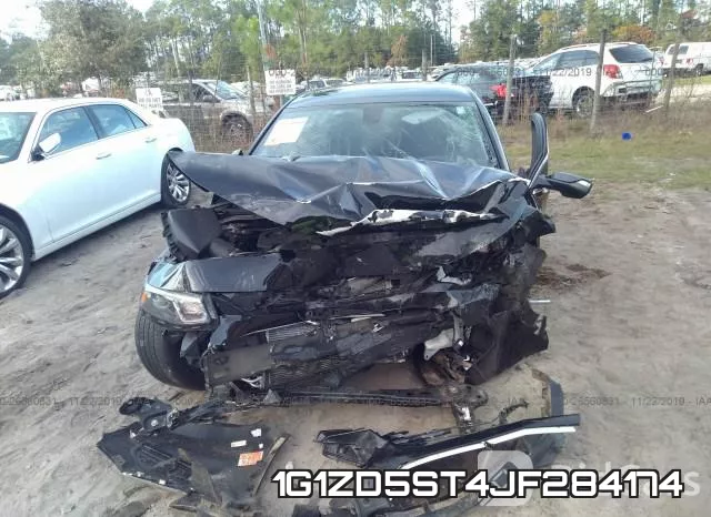 1G1ZD5ST4JF284174 фото 6