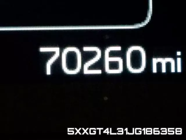 5XXGT4L31JG186358 фото 9