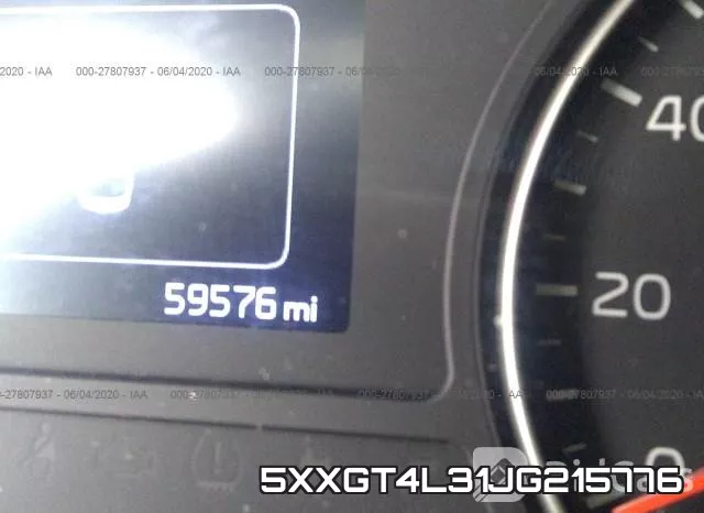 5XXGT4L31JG215776 фото 8