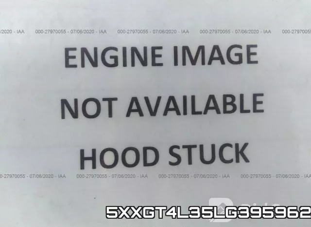 5XXGT4L35LG395962 фото 2