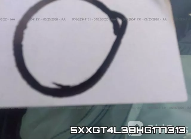 5XXGT4L38HG177313 фото 6