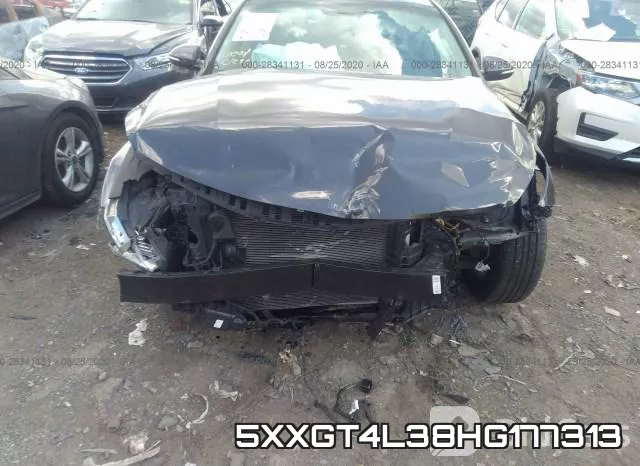 5XXGT4L38HG177313 фото 7