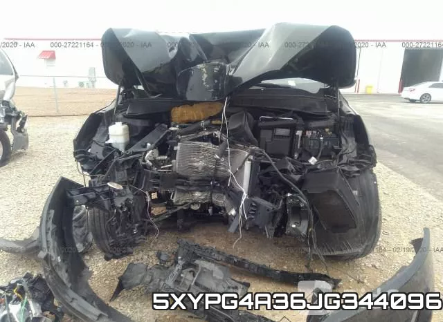 5XYPG4A36JG344096 фото 7
