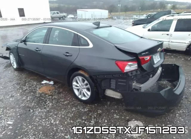 1G1ZD5STXJF157283 фото 4