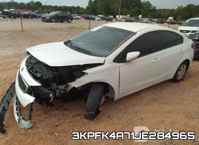 3KPFK4A71JE284965 фото 3
