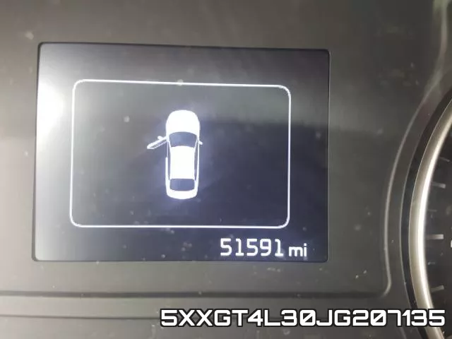 5XXGT4L30JG207135 фото 9