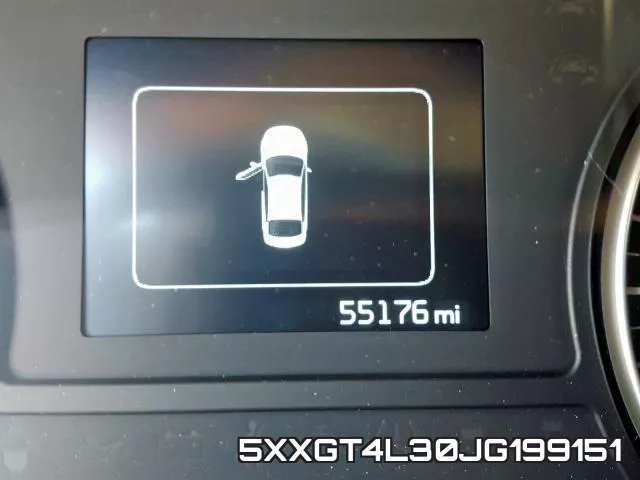 5XXGT4L30JG199151 фото 9
