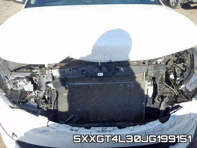 5XXGT4L30JG199151 фото 10