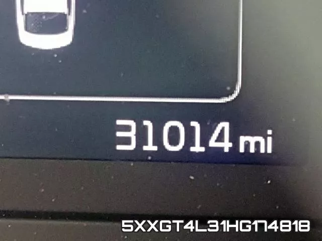 5XXGT4L31HG174818 фото 9