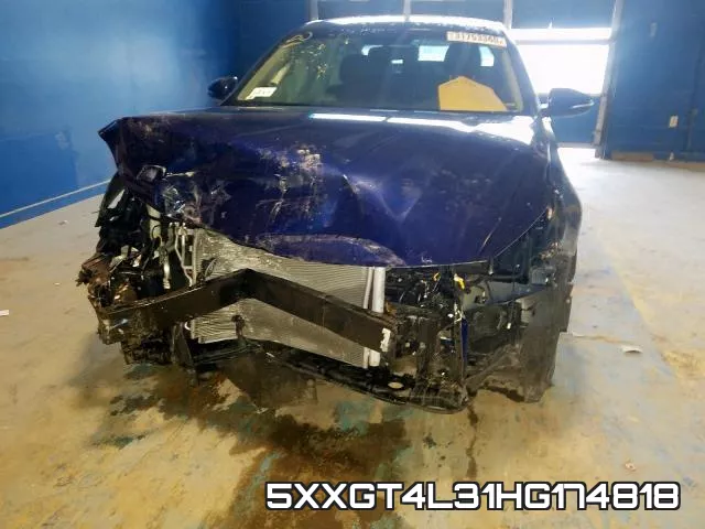 5XXGT4L31HG174818 фото 10
