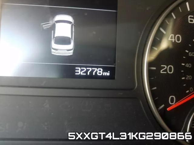 5XXGT4L31KG290866 фото 9