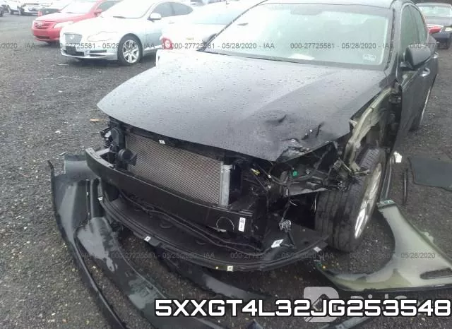 5XXGT4L32JG253548 фото 7