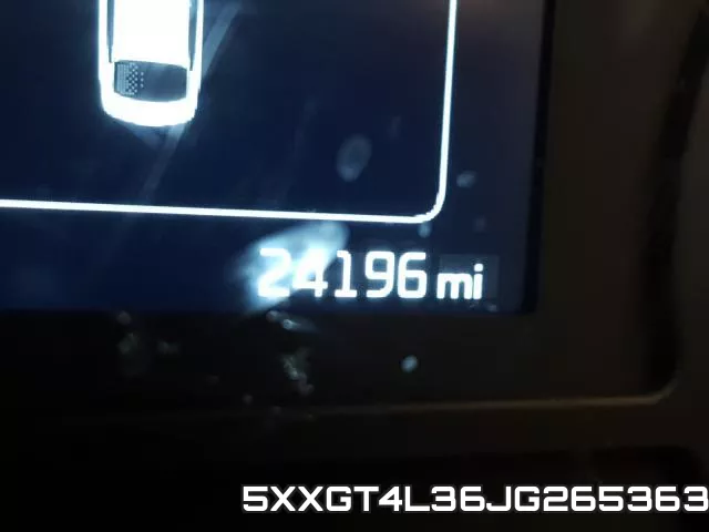5XXGT4L36JG265363 фото 9