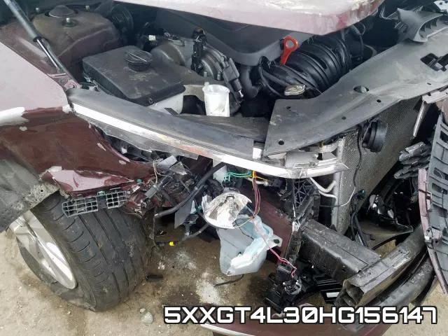 5XXGT4L30HG156147 фото 10