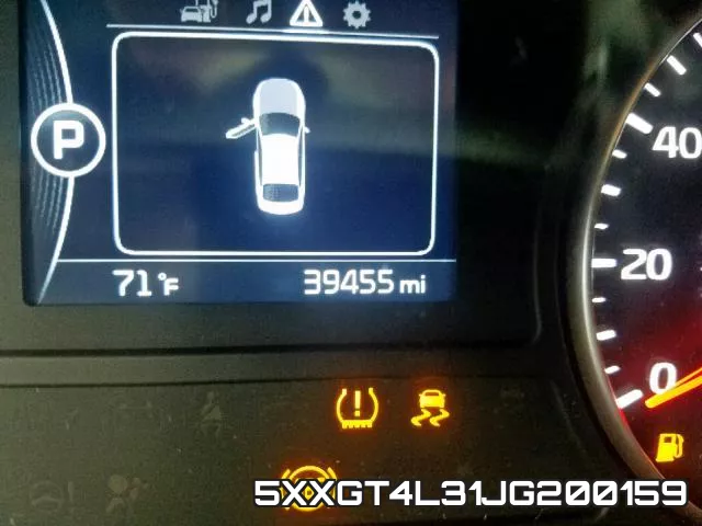 5XXGT4L31JG200159 фото 9