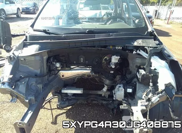 5XYPG4A30JG408875 фото 2