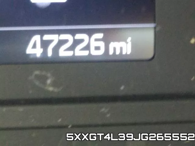 5XXGT4L39JG265552 фото 9