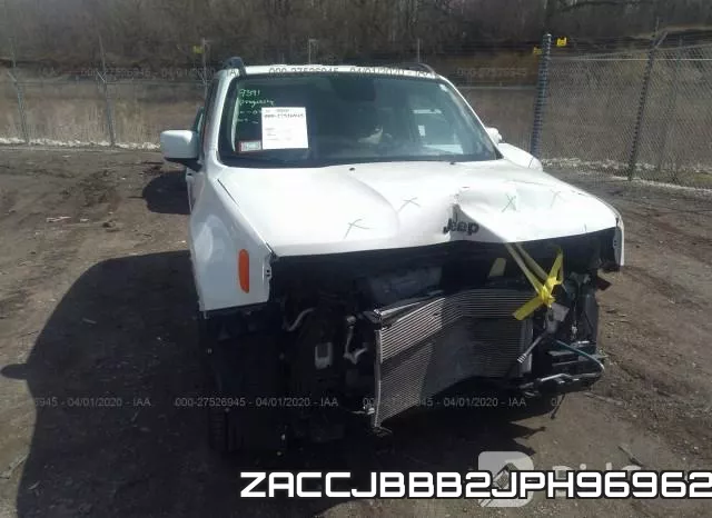ZACCJBBB2JPH96962 фото 7