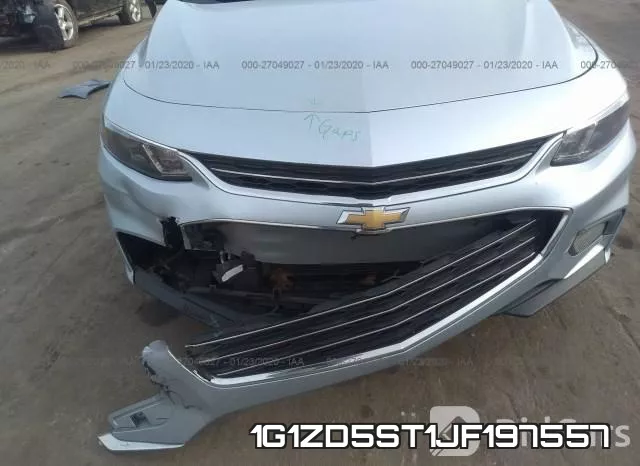 1G1ZD5ST1JF197557 фото 7