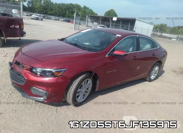 1G1ZD5ST6JF135975 фото 3