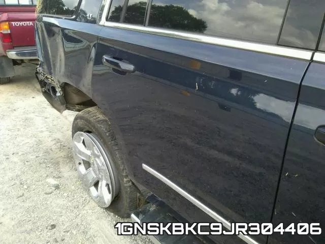 1GNSKBKC9JR304406 фото 10
