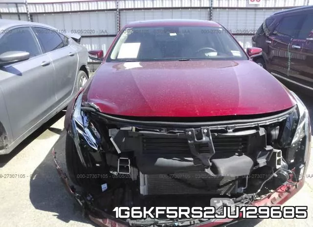 1G6KF5RS2JU129685 фото 7