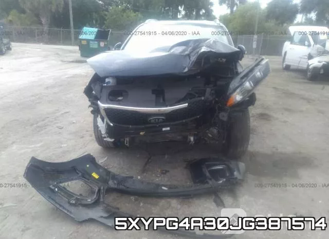5XYPG4A30JG387574 фото 7