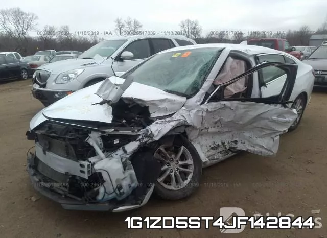 1G1ZD5ST4JF142844 фото 3