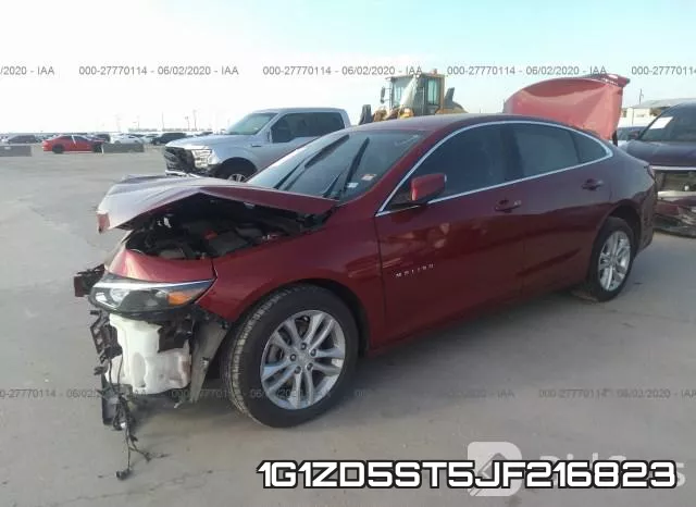 1G1ZD5ST5JF216823 фото 3