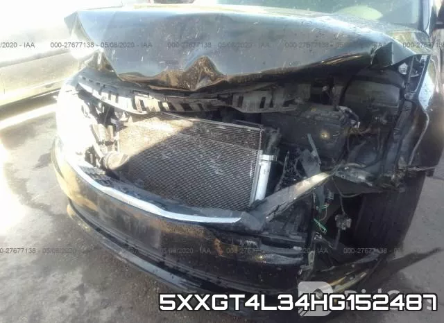 5XXGT4L34HG152487 фото 6