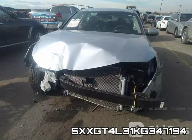 5XXGT4L31KG347194 фото 7