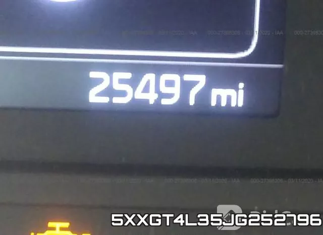 5XXGT4L35JG252796 фото 8