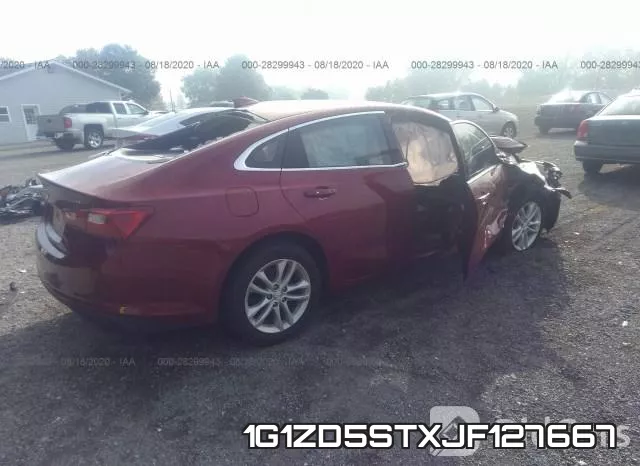 1G1ZD5STXJF127667 фото 5