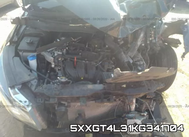 5XXGT4L31KG341704 фото 7
