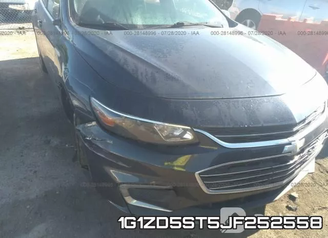 1G1ZD5ST5JF252558 фото 7