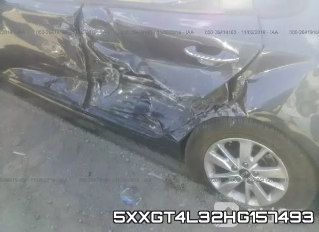 5XXGT4L32HG157493 фото 7