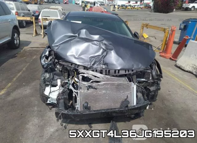 5XXGT4L36JG195203 фото 7