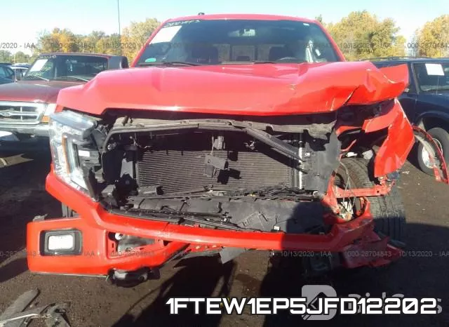 1FTEW1EP5JFD12202 фото 7