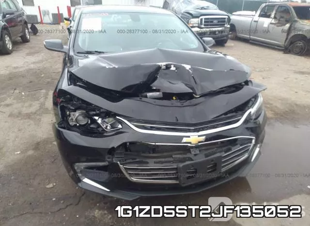 1G1ZD5ST2JF135052 фото 7