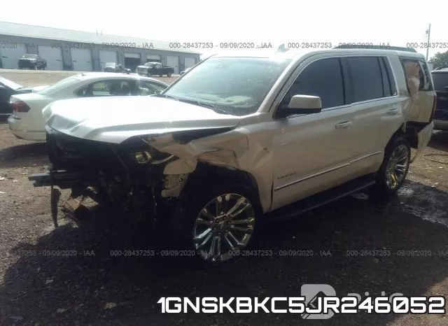 1GNSKBKC5JR246052 фото 3