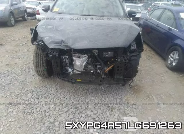 5XYPG4A57LG691263 фото 7