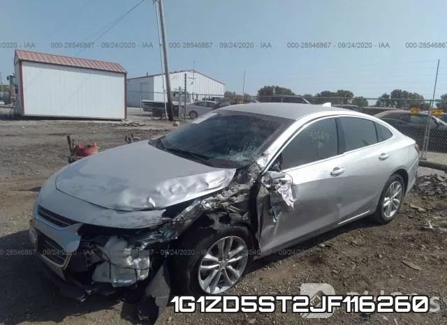 1G1ZD5ST2JF116260 фото 3