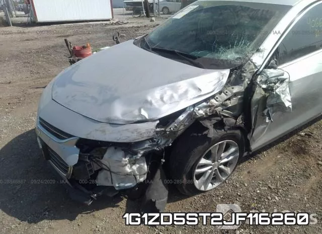 1G1ZD5ST2JF116260 фото 7