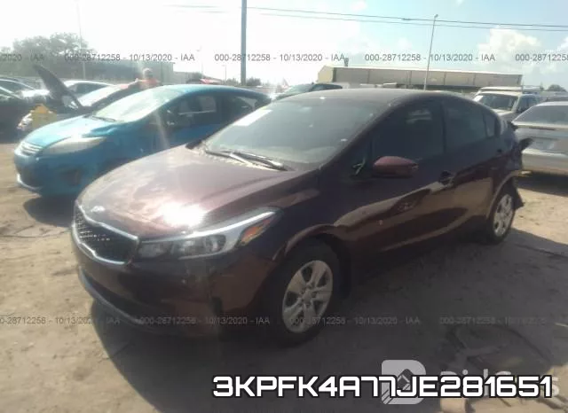 3KPFK4A77JE281651 фото 3