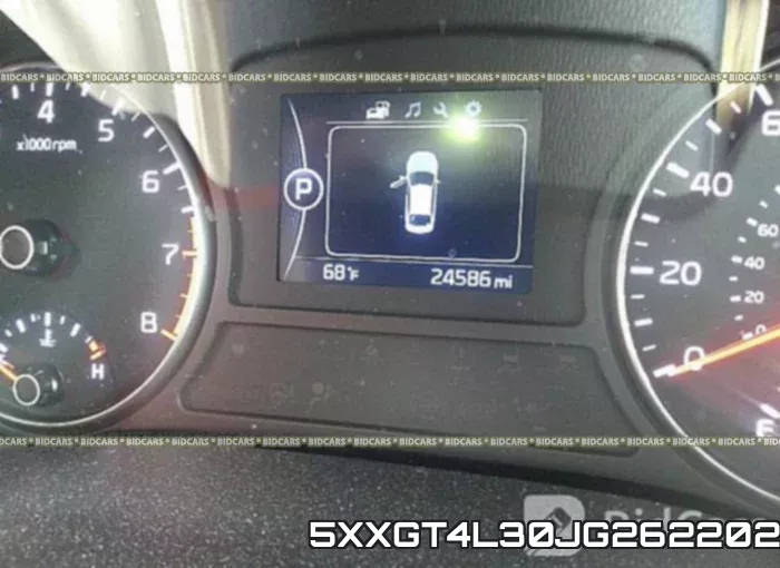5XXGT4L30JG262202 фото 8
