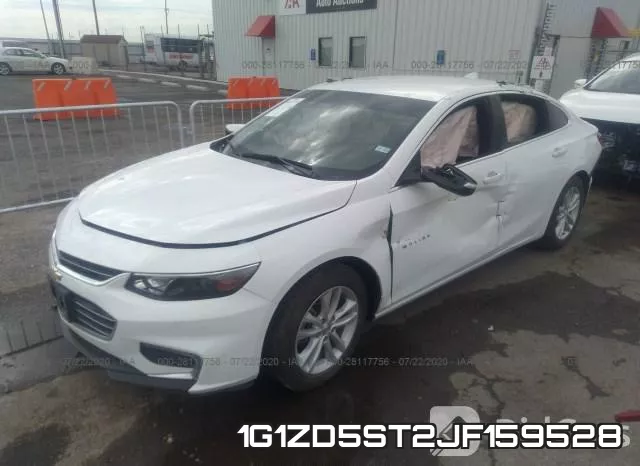 1G1ZD5ST2JF159528 фото 3