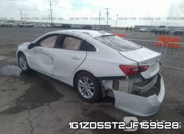 1G1ZD5ST2JF159528 фото 4